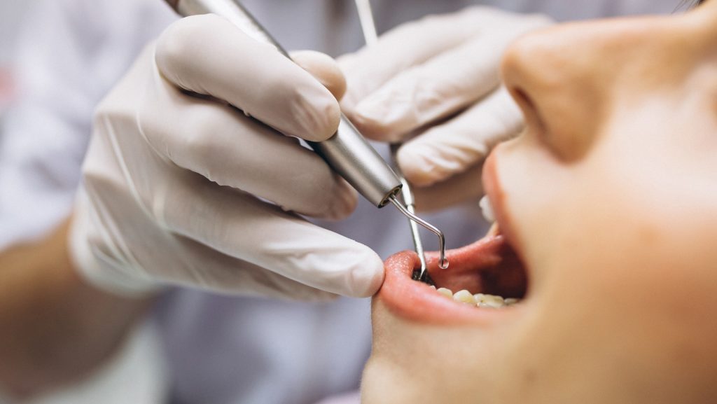 wisdom-tooth-extraction-1