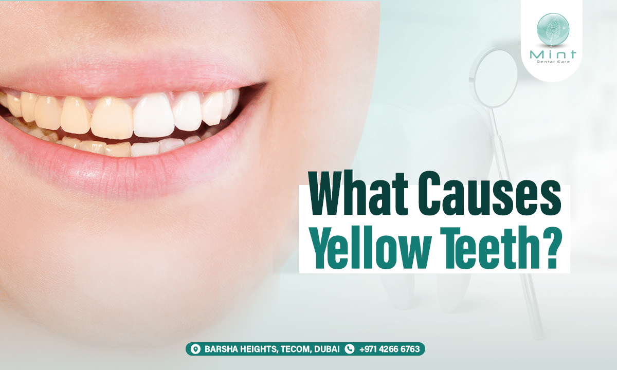 What Causes Yellow Teeth? Understanding Stains and Discoloration