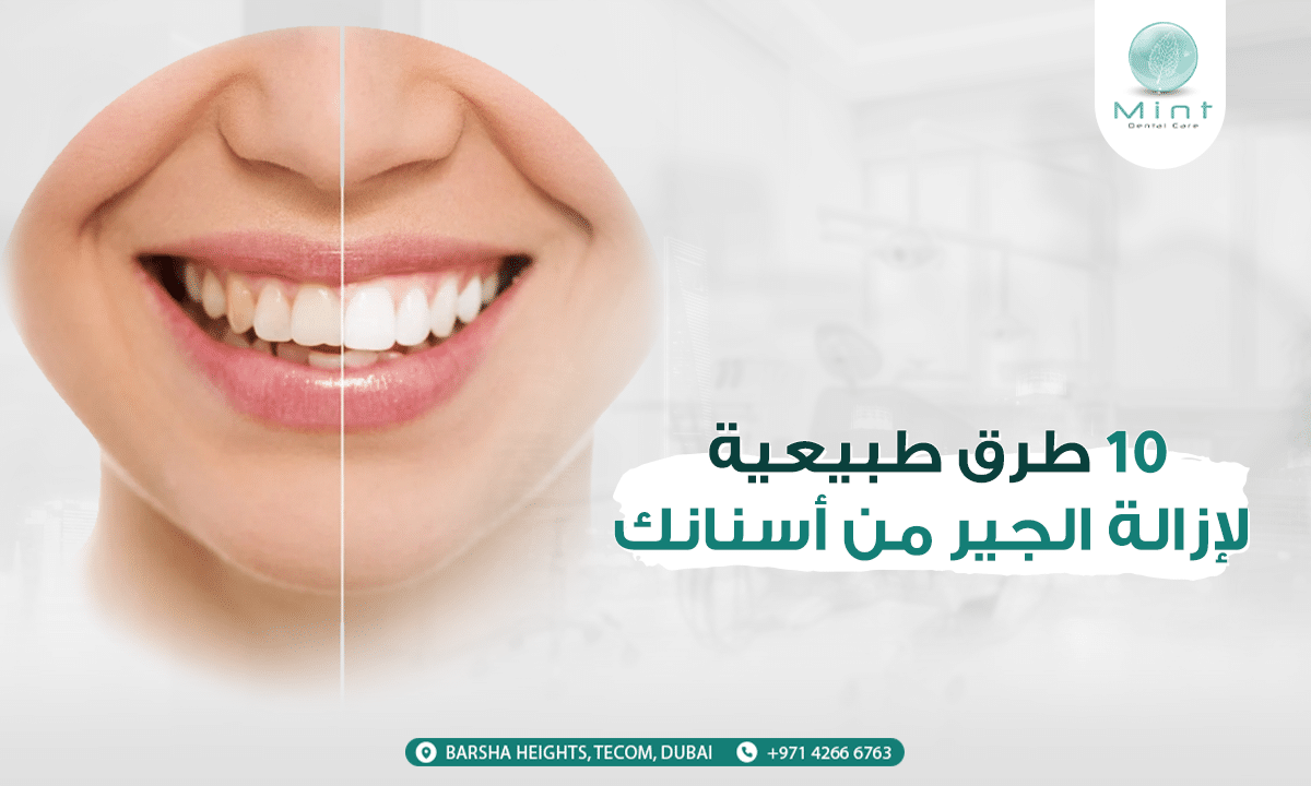 10 طرق طبيعية لإزالة الجير من أسنانك