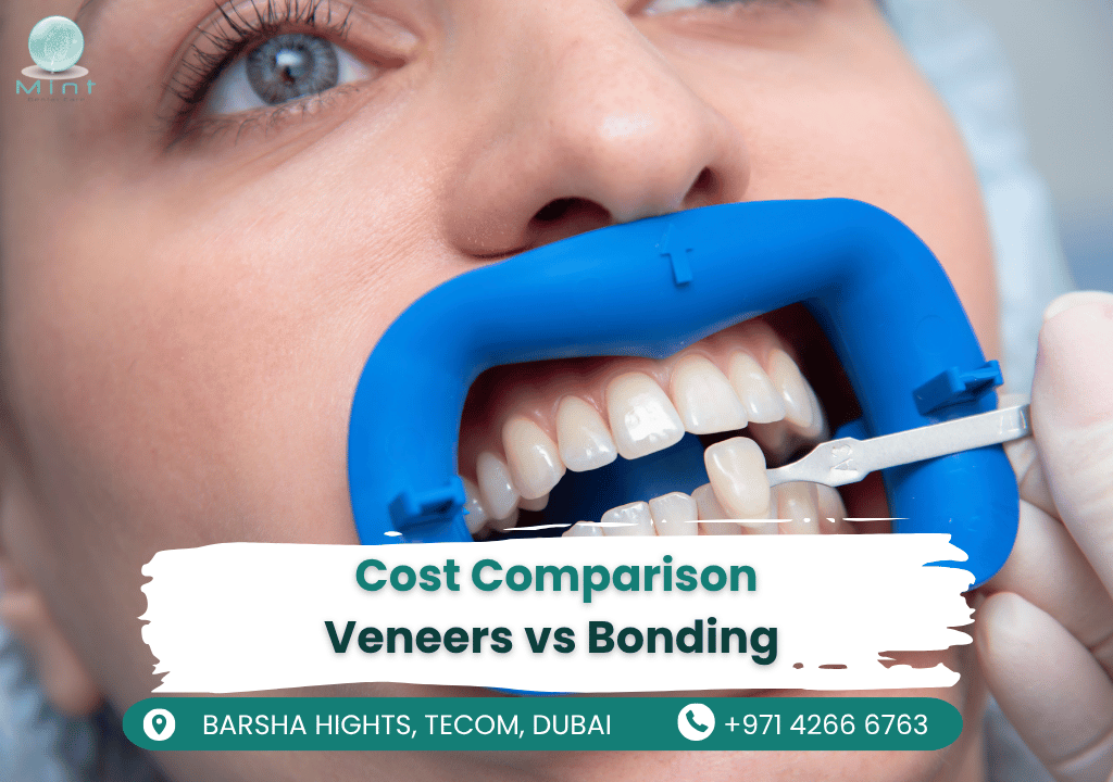 Side-by-side smile comparison showing dental veneers vs. bonding results, with cost and longevity factors highlighted.