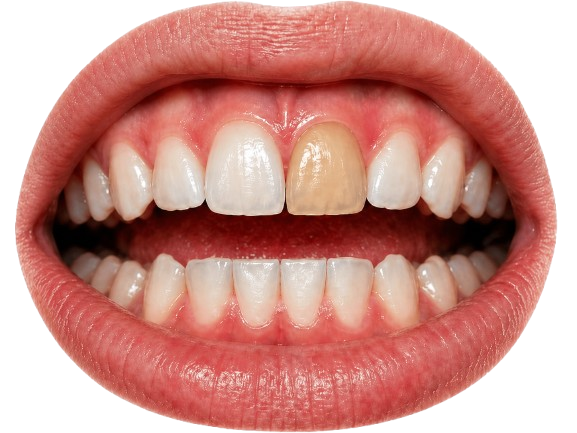 Cosmetic Dentistry
