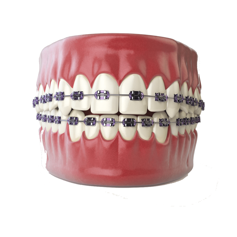 Orthodontics