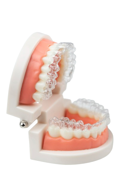 Invisalign