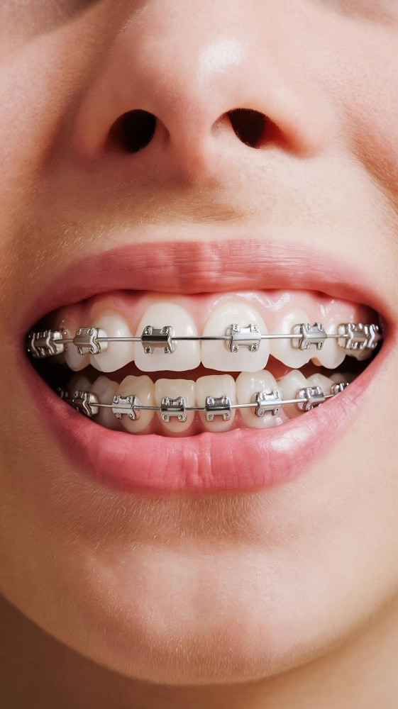 Orthodontics