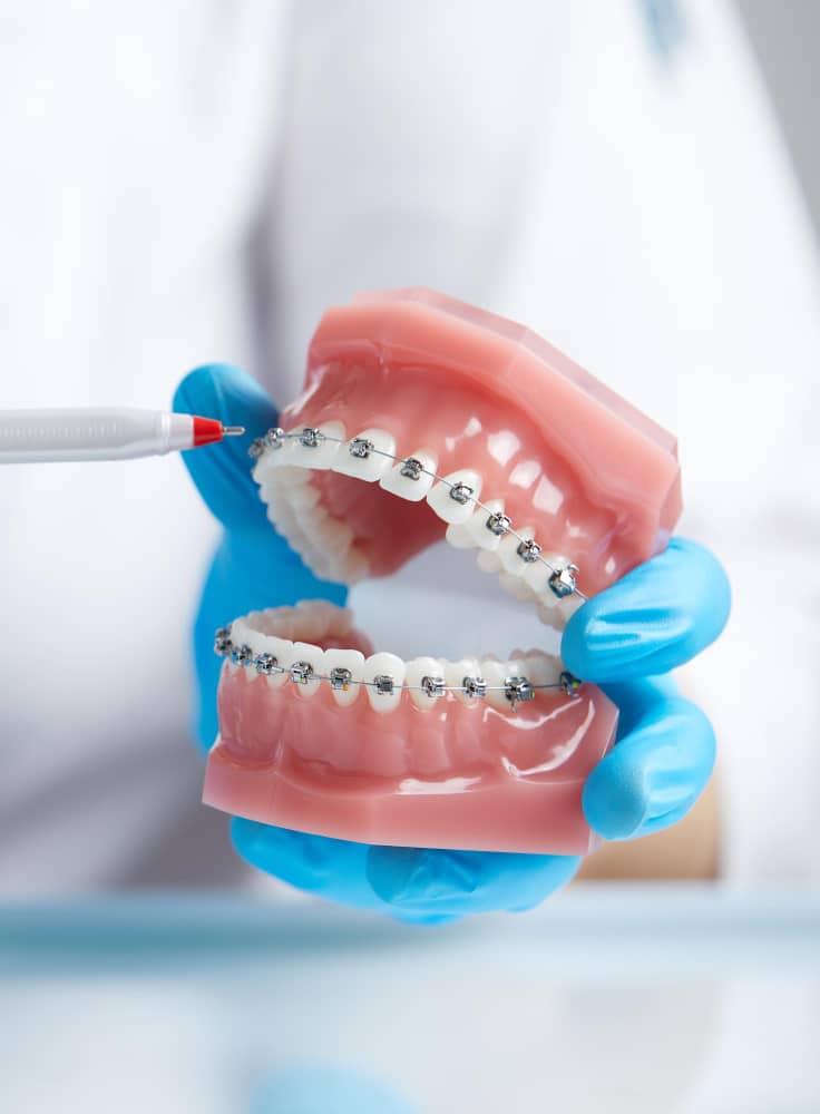 Orthodontics